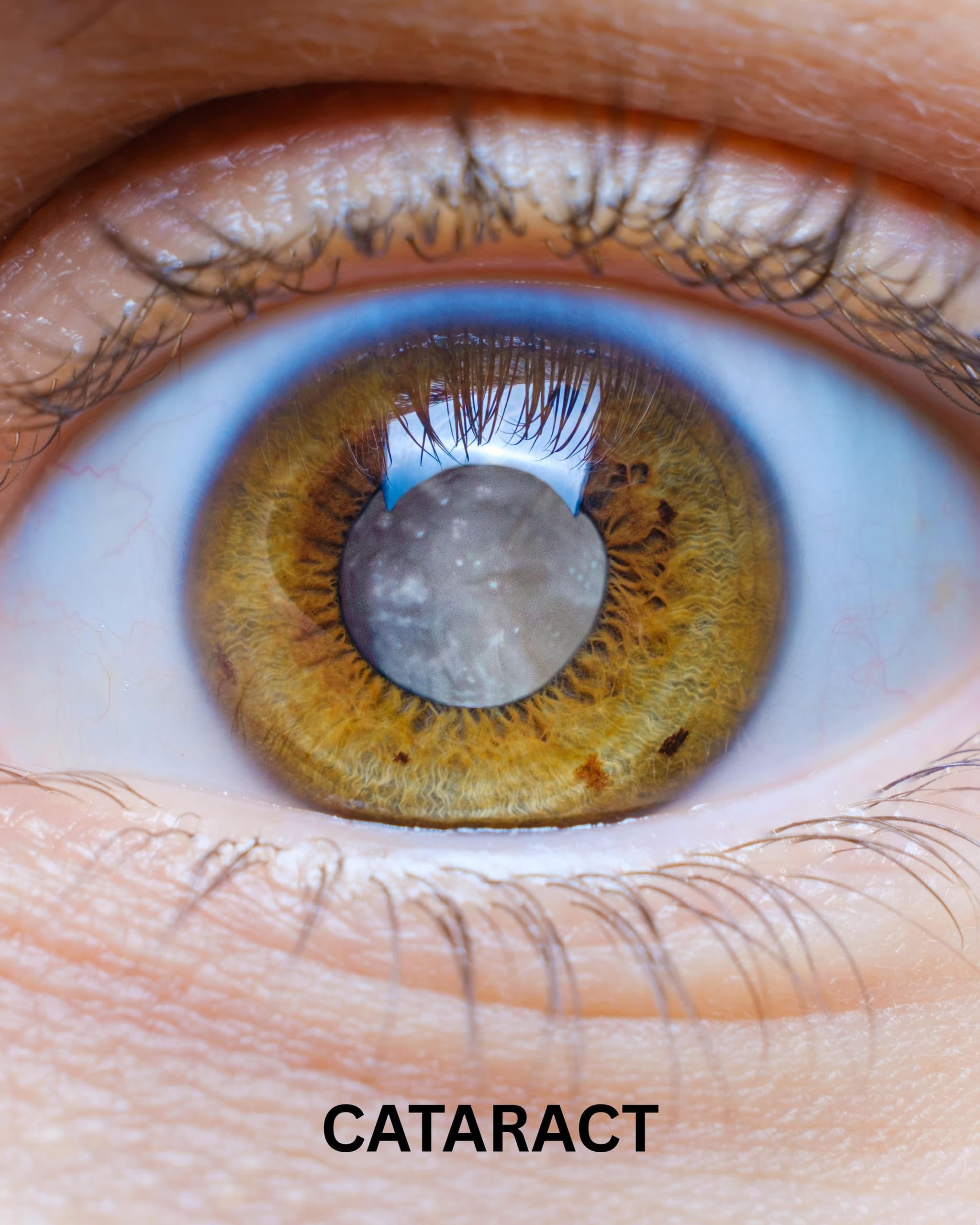 img of a girl posing